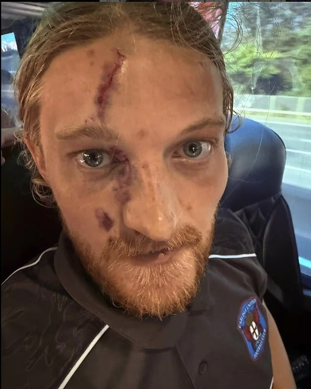 太拼了！英格蘭第五級別聯(lián)賽前鋒與門將拼搶，面部被嚴(yán)重劃傷