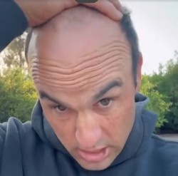 太陽報：前美國國腳多諾萬為脫發(fā)苦惱，向粉絲求助幫忙挑假發(fā)
